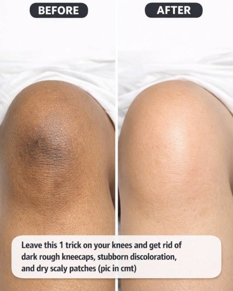 Leave this 1 trick on your knees and get rid of dark rough kneecaps,