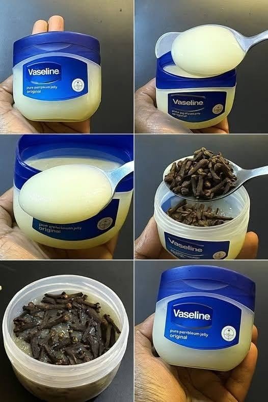 Mix cloves with petroleum jelly: a secret no one will ever tell you. Thank me later.