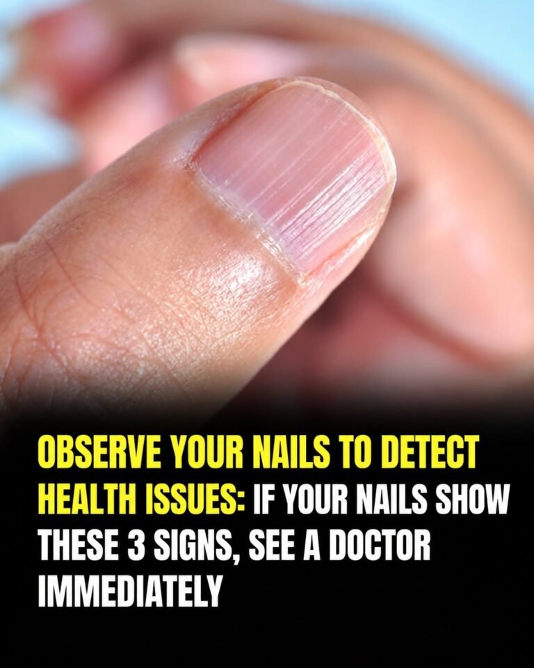 Observe Your Nails to Detect Possible Health Issues: 3 Warning Signs You Should Never Ignore